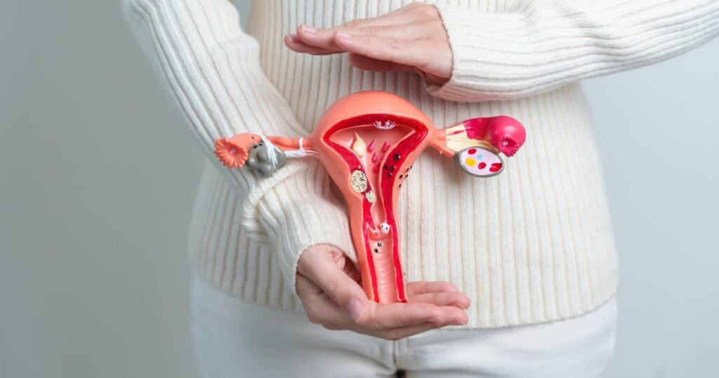 Endométriose : une maladie fréquente encore trop méconnue endométriose