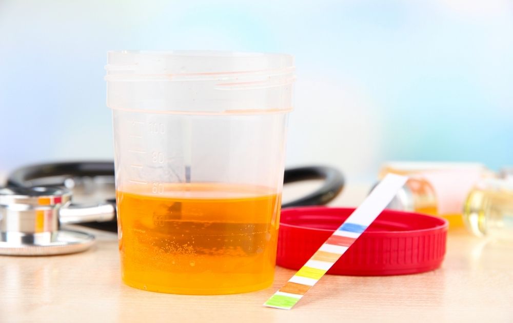 Diabète et infections urinaires trod cystite pour dépister une infection urinaire