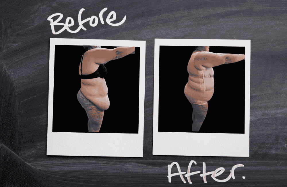 Notre service : Ceinture abdominale sur-mesure avis lipoline de marie