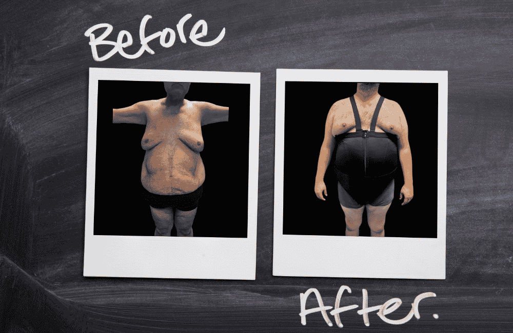 Notre service : Ceinture abdominale sur-mesure avis lipoline de pierre