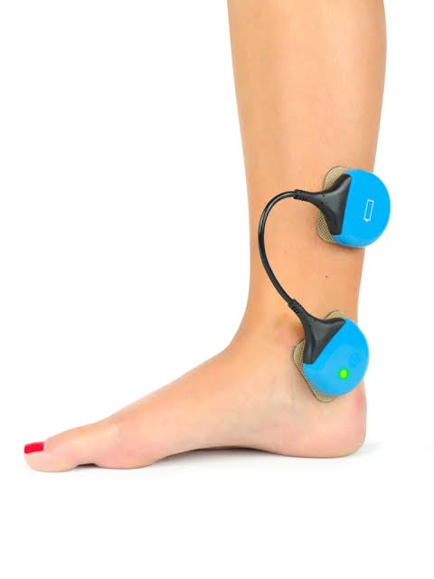 urostim wireless