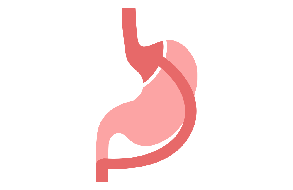 bypass gastrique